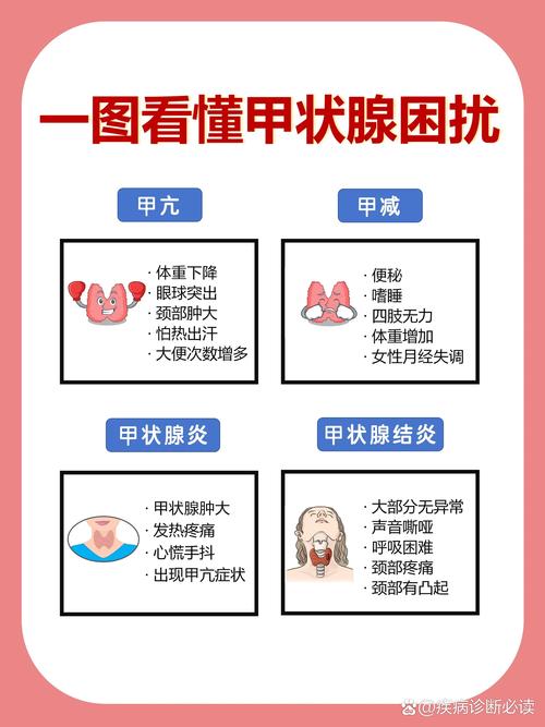 医生强调：甲状腺早期不是脖子粗大，而是身体有这4异常，要留意